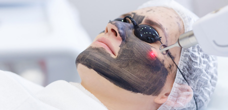 Laser Skin Treatment