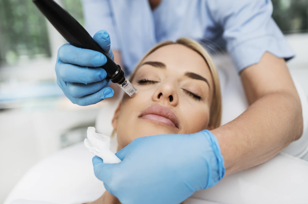 Experience the rejuvenating effects of microneedling at Bellatudo Skin and Wellness Center: Stimulate collagen and achieve smoother, firmer skin!