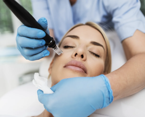 Experience the rejuvenating effects of microneedling at Bellatudo Skin and Wellness Center: Stimulate collagen and achieve smoother, firmer skin!