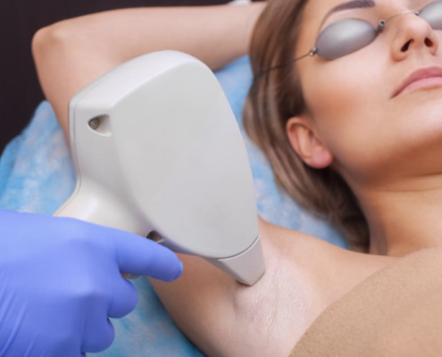 Experience the freedom of smooth skin with laser hair removal at Bellatudo Skin and Wellness Center: Say goodbye to unwanted hair!